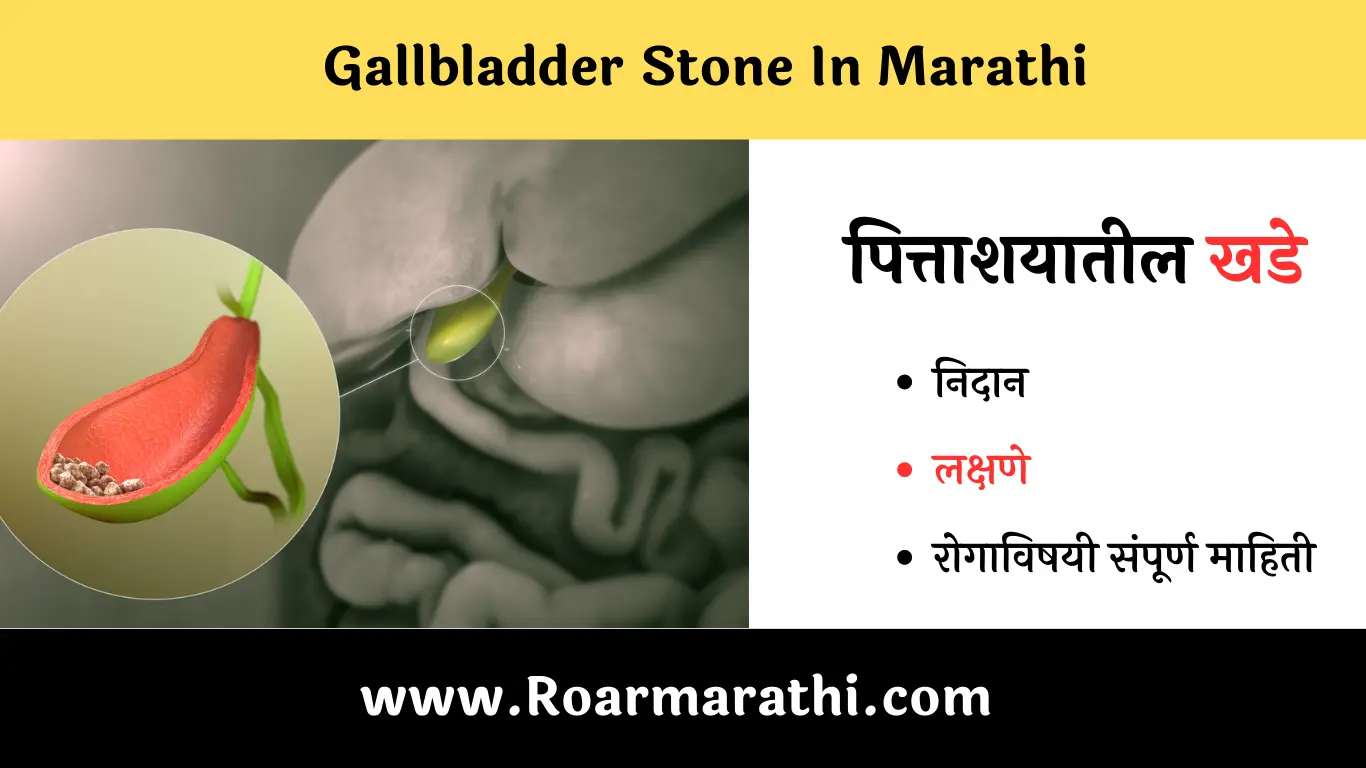 Gallbladder Stone In Marathi | पित्ताशयातील खडेची माहिती - Roar Marathi