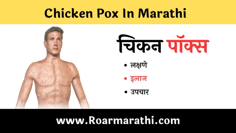 chicken pox in marathi
